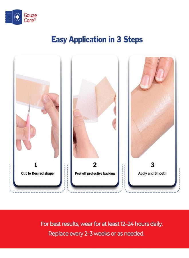 غوز_كير شريط سيليكون GauzeCare لعلاج الندبات - لفة 1.6 بوصة × 120 بوصة - شريط سيليكون طبي قابل لإعادة الاستخدام، مناسب للندبات الجراحية، وندبات الولادة القيصرية، والحروق، والندبات الجدرية، وندبات حب الشباب. - Image 3
